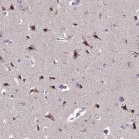 Anti-INPP4A antibody produced in rabbit 