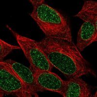 Anti-INPP4A antibody produced in rabbit 