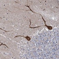 Anti-INPPL1 antibody produced in rabbit 