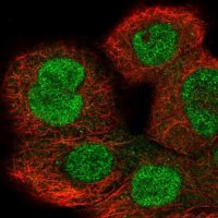 Anti-IPO8 antibody produced in rabbit 