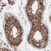 Anti-IPPK antibody produced in rabbit