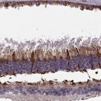 Anti-IQCB1 antibody produced in rabbit 
