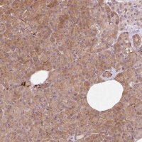 Anti-IQGAP2 antibody produced in rabbit 