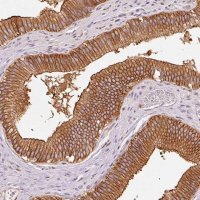 Anti-IQGAP2 antibody produced in rabbit 