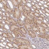 Anti-IRAK2 antibody produced in rabbit