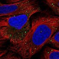 Anti-IRAK2 antibody produced in rabbit