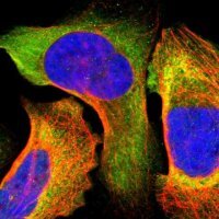 ANTI-IRF9 antibody produced in rabbit 