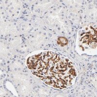 Anti-ITGA8 antibody produced in rabbit 