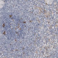 Anti-ITGAD antibody produced in rabbit