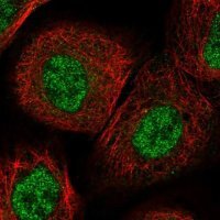 Anti-ITGB3BP antibody produced in rabbit 