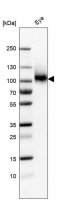 Anti-ITGB8 antibody produced in rabbit 
