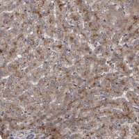 Anti-ITIH3 antibody produced in rabbit 