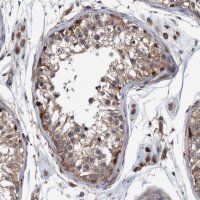 Anti-ITIH3 antibody produced in rabbit 