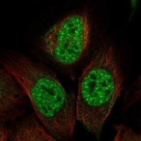 Anti-ITPKC antibody produced in rabbit
