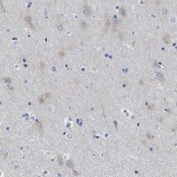 Anti-ITPR1 antibody produced in rabbit 
