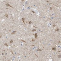 Anti-ITPR1 antibody produced in rabbit HPA014765-100UL