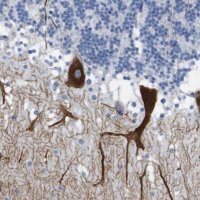 Anti-ITPR1 antibody produced in rabbit HPA014765-100UL