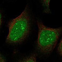 Anti-JAZF1 antibody produced in rabbit 
