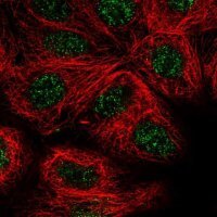 Anti-JDP2 antibody produced in rabbit 