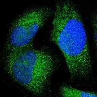 Anti-JMJD7 antibody produced in rabbit 