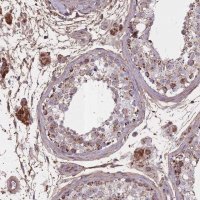 Anti-KAT2A antibody produced in rabbit