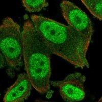 Anti-KAT7 antibody produced in rabbit