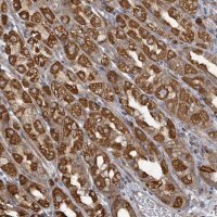 Anti-KBTBD11 antibody produced in rabbit HPA051159-100UL