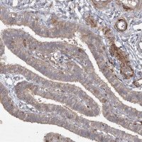Anti-KBTBD4 antibody produced in rabbit 