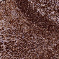 Anti-KBTBD6 antibody produced in rabbit HPA048914-100UL