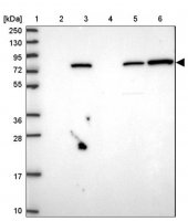 Anti-KBTBD6 antibody produced in rabbit HPA048914-100UL