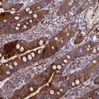 Anti-KBTBD7 antibody produced in rabbit 