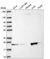 Anti-KBTBD8 antibody produced in rabbit HPA069190-100UL