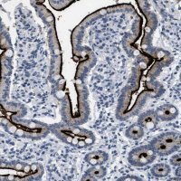 Anti-KCNC3 antibody produced in rabbit