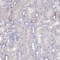 Anti-KCNK5 antibody produced in rabbit 