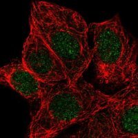 Anti-KCNK5 antibody produced in rabbit 