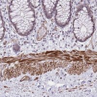 Anti-KCNN4 antibody produced in rabbit 