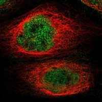 Anti-KCTD10 antibody produced in rabbit