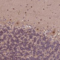 Anti-KCTD11 antibody produced in rabbit 