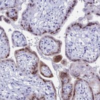Anti-KCTD21 antibody produced in rabbit 