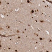 Anti-KHDRBS3 antibody produced in rabbit