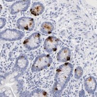 Anti-KHNYN antibody produced in rabbit 