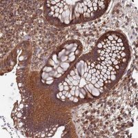 Anti-KIAA0391 antibody produced in rabbit 