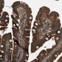 Anti-KIAA0430 antibody produced in rabbit 