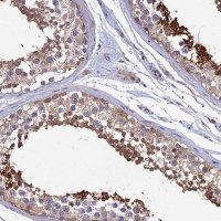 Anti-KIAA1211 antibody produced in rabbit 