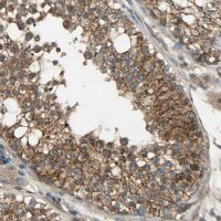 Anti-KIAA1217 antibody produced in rabbit