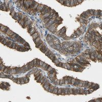 Anti-KIAA1217 antibody produced in rabbit