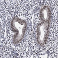 Anti-KIAA1429 antibody produced in rabbit 