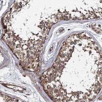 Anti-KIAA1524 antibody produced in rabbit 