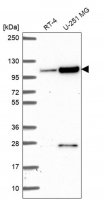 Anti-KIAA1614 antibody produced in rabbit HPA061684-100UL