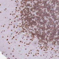 Anti-KIAA1644 antibody produced in rabbit 